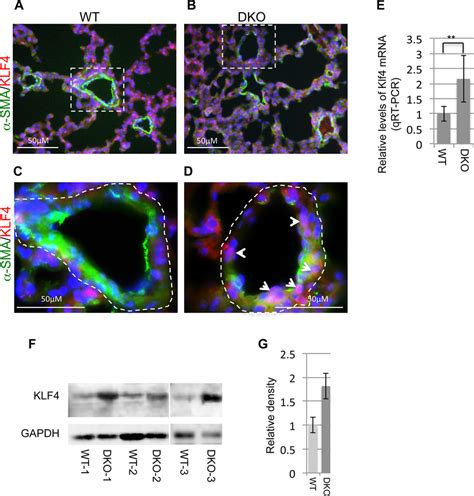 Upregulation Of Klf In Mir Null Lungs A B Double If Staining Of