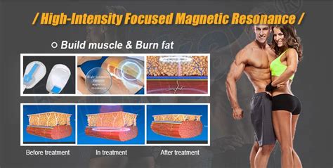 Ems Muscle Stimulate Ems Pelvic Floor Muscle Repair Fat Burn 4 Handle