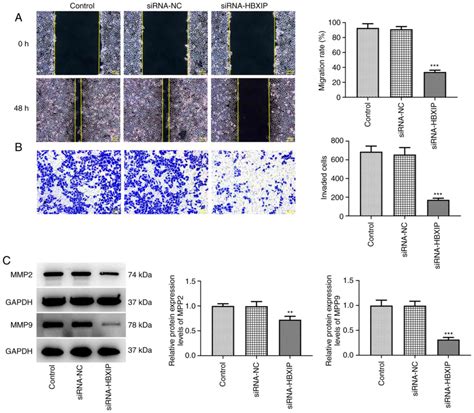 HBXIP Knockdown Inhibits FHL2 To Promote Cycle Arrest And Suppress