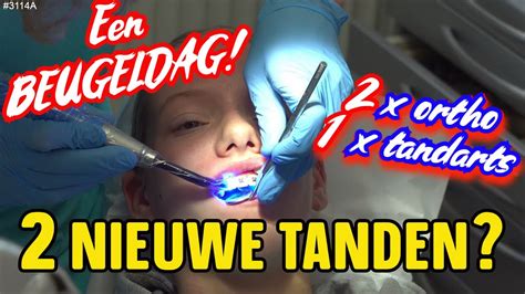 Een Beugel Dag De Tandarts Maakt Nieuwe Tanden Deed Dit Pijn Dit