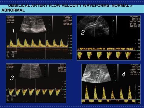 Fetal Cardiac Function Ppt Download