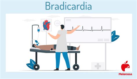 Bradicardia Che Cos Cause Sintomi Diagnosi Cure