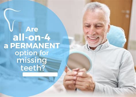 Are All On Implants A Permanent Solution For Missing Teeth