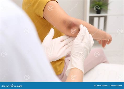 Doctor Examining Woman With Bruise On Elbow In Clinic Closeup Stock