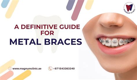 Metal Braces For Your Teeth: A Definitive Guide