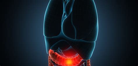 Combined Immunotherapy May Work for Certain Colorectal Cancer