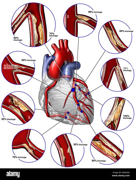 Arteria Coronaria Circunfleja Fotograf As E Im Genes De Alta Resoluci N