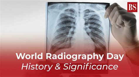 World Radiography Day History And Significance Video Gallery Business