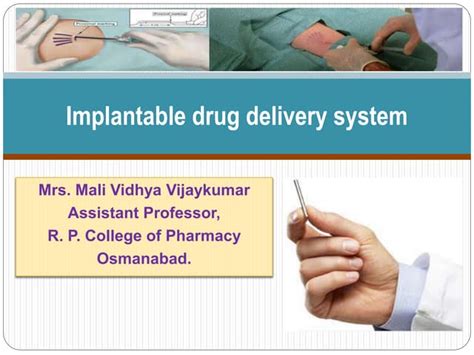 Implantable Drug Delivery System