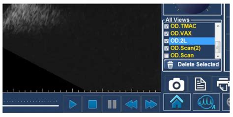 Rev B Accutome Connect Ultrasound System User Guide