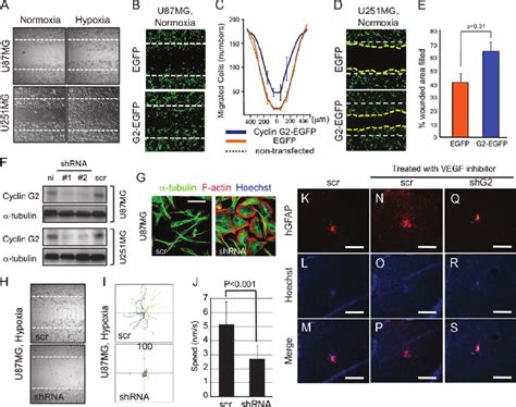 Cyclin G Promotes Glioblastoma Cell Migration And Is Required For The