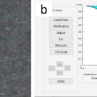 A Concave Profile At The Contact Area Was Found Visually In Restored