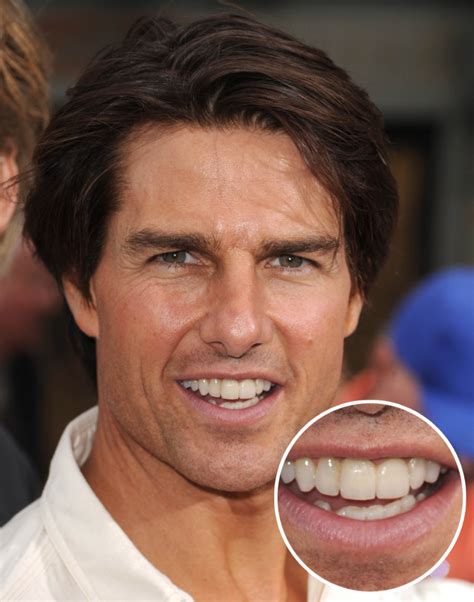 Tom Cruise's Middle Tooth — the Story Behind His Smile