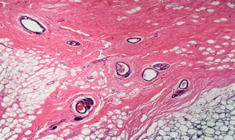 Human Breast Cell Atlas Reveals All Cells In Human Breast Tissue With