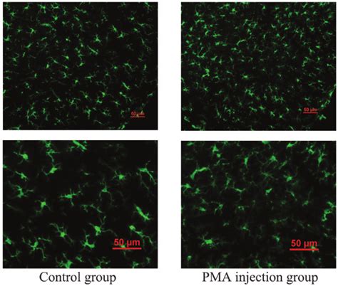 Immunofluorescence Staining Of Iba 1 In The Microglia In The Substantia