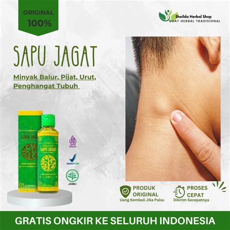 Jual Minyak Sapu Jagat Minyak Oles Benjolan Lipoma Di Leher Kista