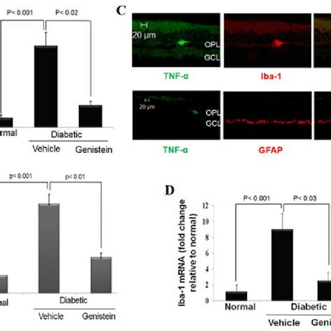 Accumulation Of Glycated Albumin In Diabetic Retina And Its