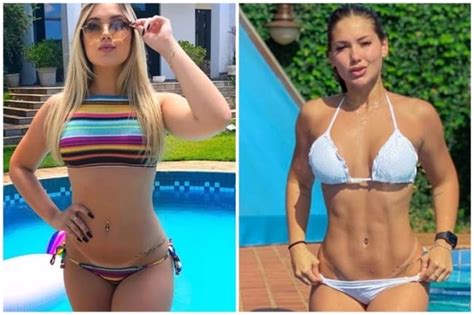 Antes E Depois Lipo Lad Das Famosas Pl Stica Dos Famosos