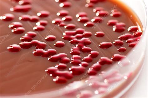 Serratia marcescens culture - Stock Image - C036/9184 - Science Photo ...