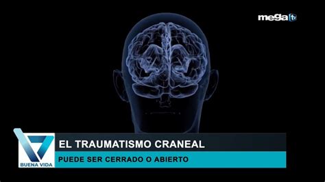 Buena Vida El Traumatismo Craneal Puede Ser Cerrado O Abierto