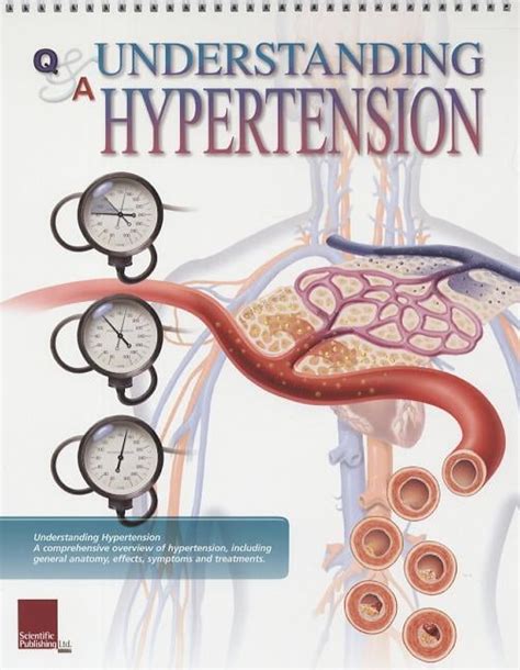 Understanding Hypertension Flip Chart Other Walmart