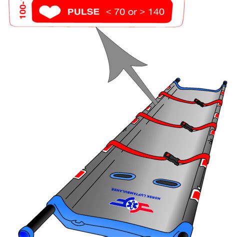 Modified Triage Sieve Action Card Adult 140 Cm Triage Sieve