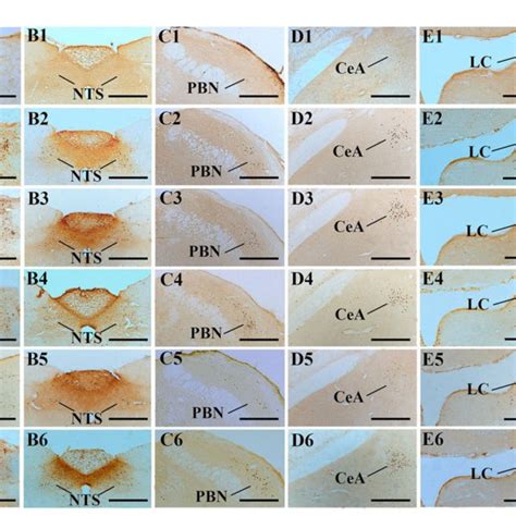 Figure Representative Photomicrographs Showing Fos Immunolabeling In Download Scientific