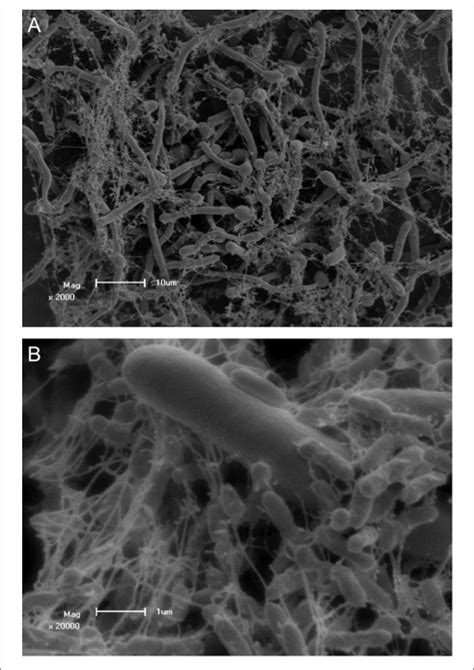 Scanning Electron Micrographs Of Candida Albicans Colonized By