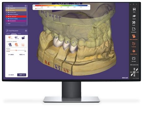 Exocad DentalCAD XYZ Dental