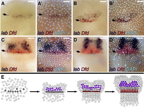 Figure From Comprehensive Analysis Of Hox Gene Expression In The