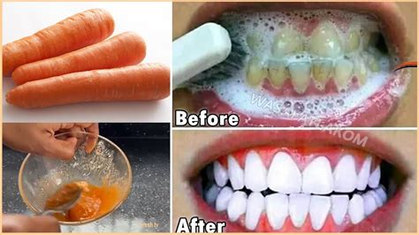 Carrot Remedy In 3 Minutes Whiten Teeth Naturally Fast Teeth Whitening At Home In 3 Minutes