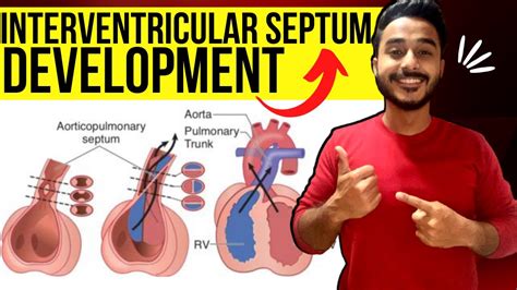 Interventricular Septum Development Embryology Development Of Heart