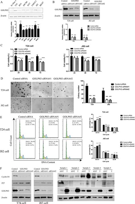 Golph Silencing Inhibited The Proliferation And Tumorigenicity Of