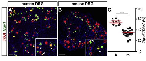 A Higher Percentage Of TRPV1 TRKA1 Positive Neurons Reside In Human