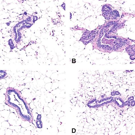 Morphologic Differences In Mammary Glands From Sexually Ma Ture Rats