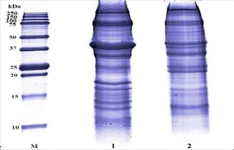 Comparison Of SDS PAGE Profiles Of Extract Of C Obtuse Lane 1 And P