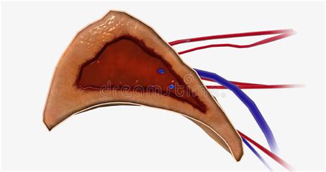 Diagnosis Adenoma Stock Illustrations 275 Diagnosis Adenoma Stock Illustrations Vectors