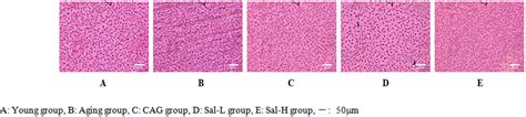 Figure 3 Effect Of Salidroside On Lipofuscin Deposition In Mouse Liver