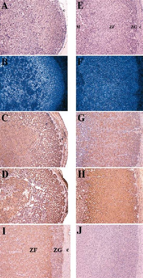 Bright Field A And E And Dark Field B And F Photomicrographs