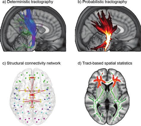 Structural Connectivity Obtained From Diffusion Tensor Imaging A