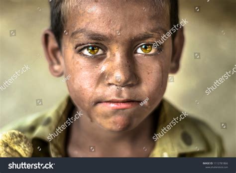 Hungry Kid Face