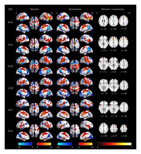 The Group Level Functional Connectivity Maps Seeded At Rois And Their