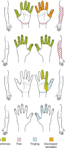 Wrist And Hand Pathologies Flashcards Quizlet