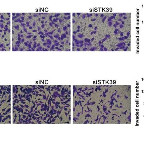 Knockdown Of STK39 Expression Inhibits Osteosarcoma Cell Invasion A