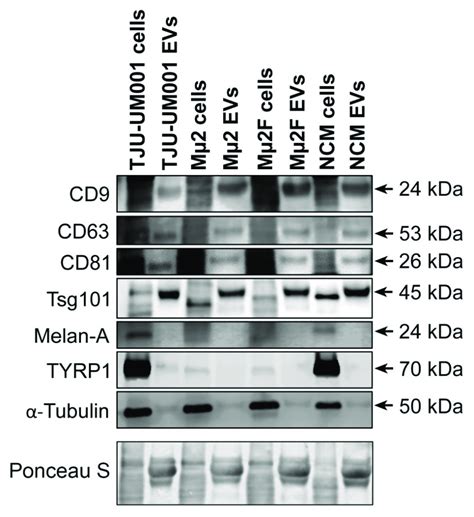 Exosomal And Melanocytic Markers Present In Um Derived Evs Cell