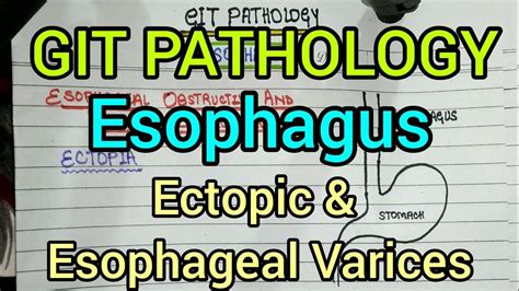 Ectopia And Esophageal Varices Git Pathology Youtube