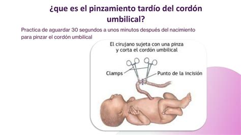 Pinzamiento tardío del cordón umbilical Araceli Terrero uDocz