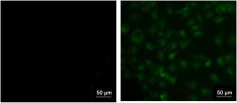 Fluorescence Microscopic Images Of Hela Cells Incubated With Probe