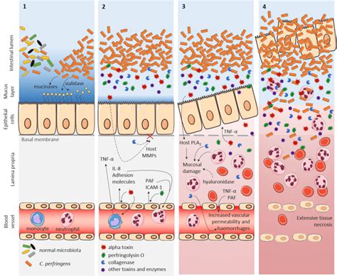 Hypothesis On Key Events In C Perfringens Type A Induced Intestinal