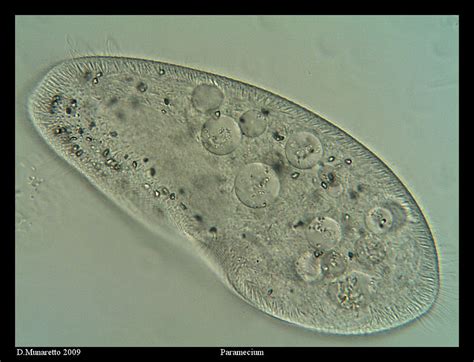 Paramecium X Labeled